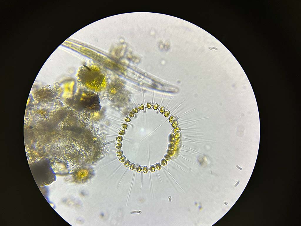 A microscope photo of the algae chaetoceros