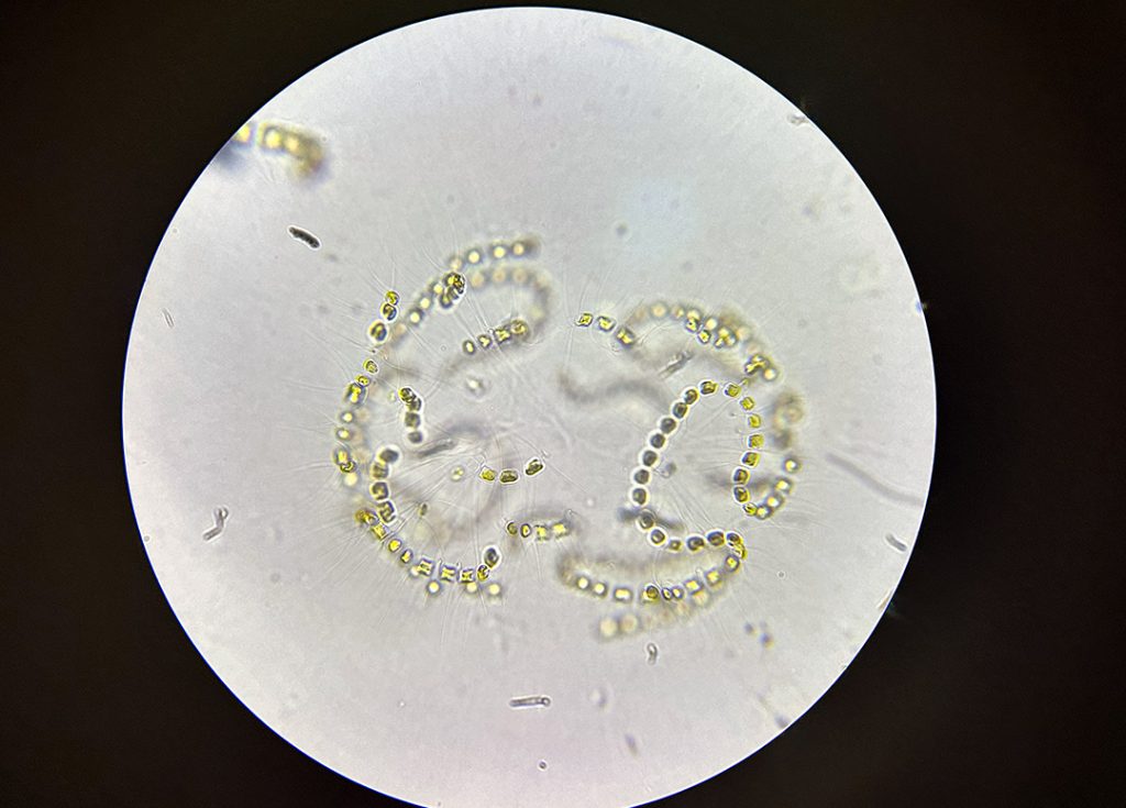 Microscope image of strands of a Chaetoceros alga